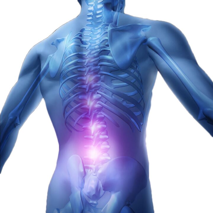 Muscle spasms and tensions cause severe pain